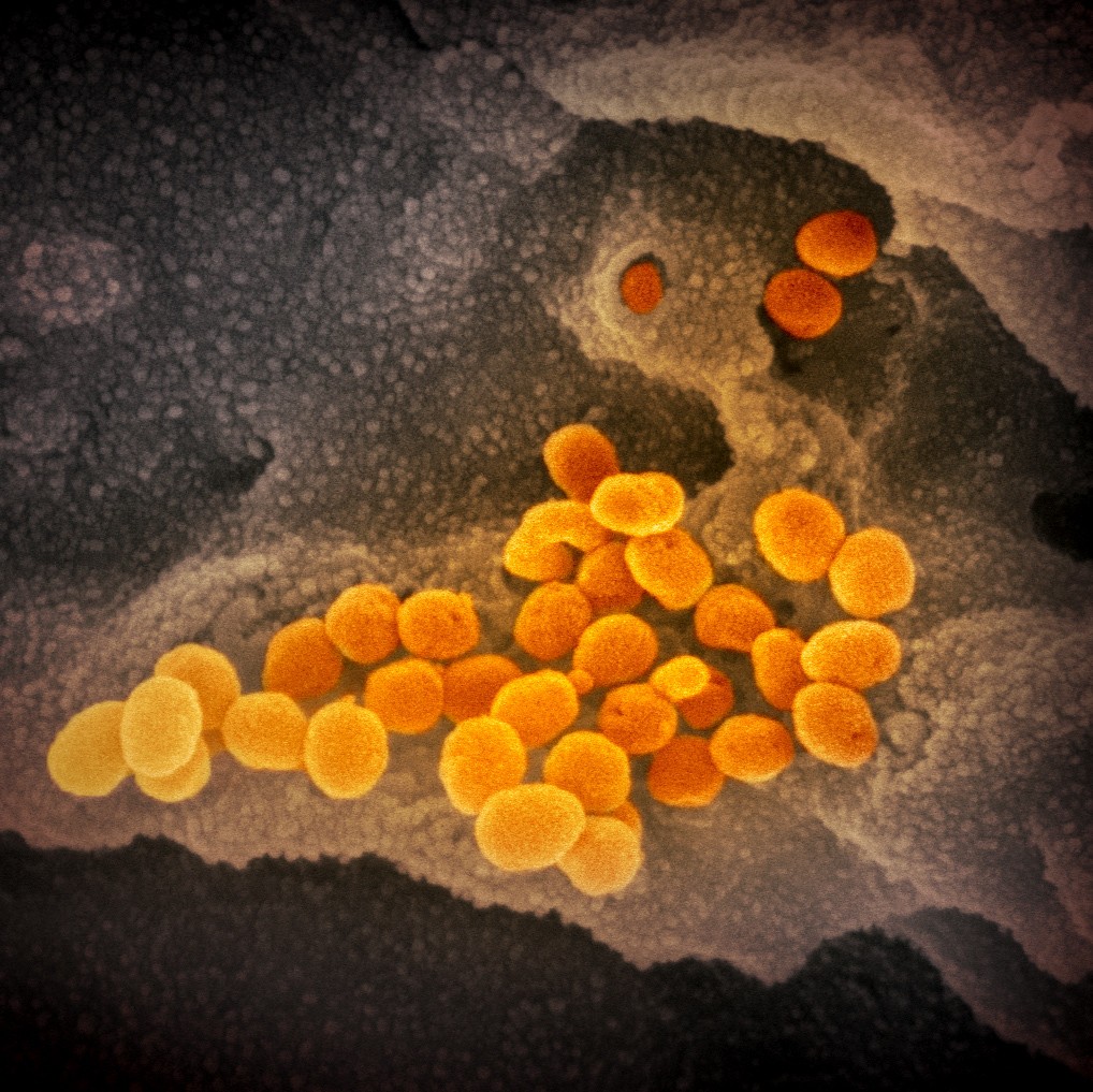 This scanning electron microscope image shows SARS-CoV-2 (orange)—also known as 2019-nCoV, the virus that causes COVID-19—isolated from a patient in the U.S., emerging from the surface of cells (gray) cultured in the lab. Image captured and colorized at NIAID's Rocky Mountain Laboratories (RML) in Hamilton, Montana. Credit: NIAID