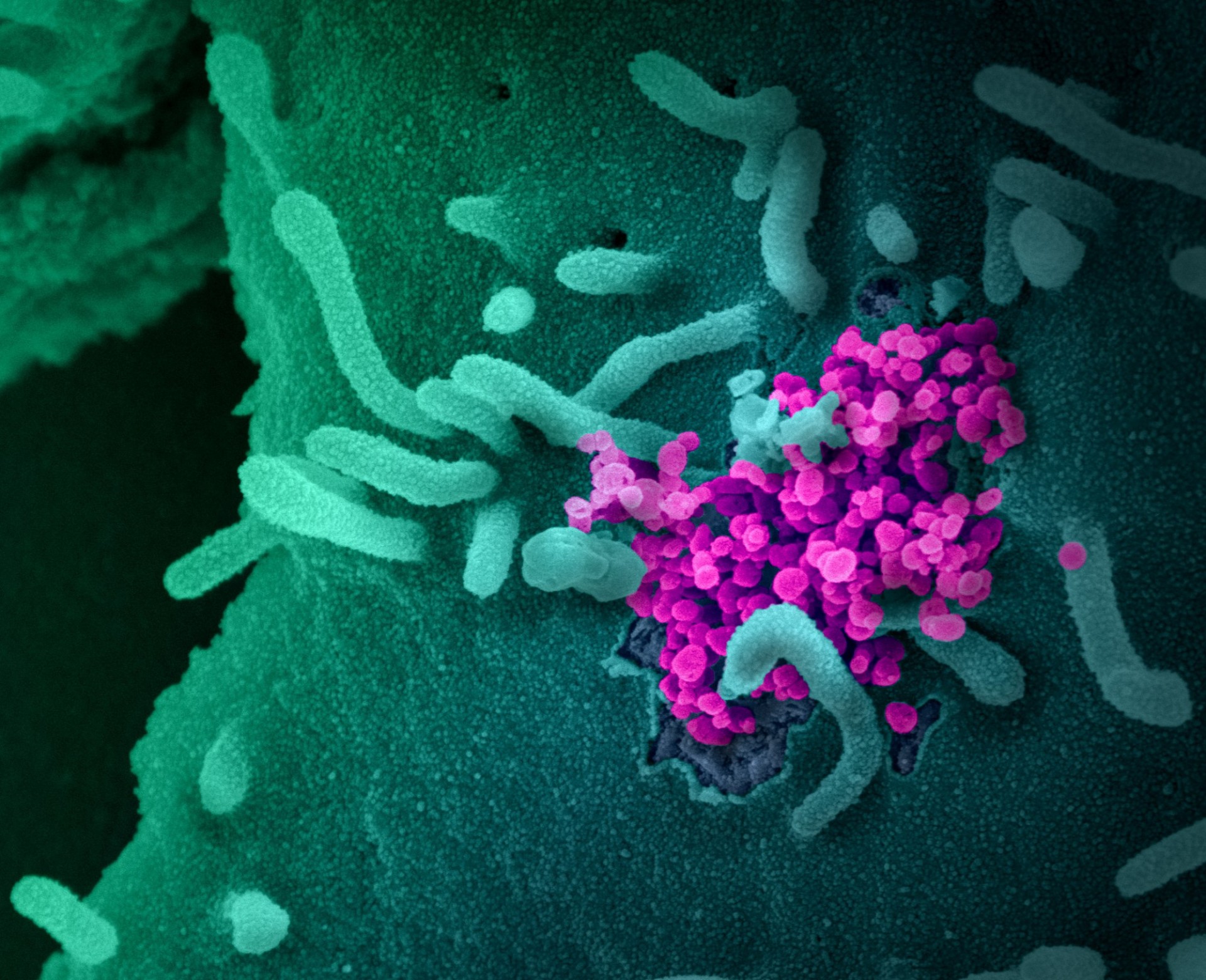 Image captured and colorized at NIAID's Rocky Mountain Laboratories (RML) in Hamilton, Montana. Credit: NIAID Scanning electron microscope image showing SARS-CoV-2 emerging from the surface of cells cultured in the lab.