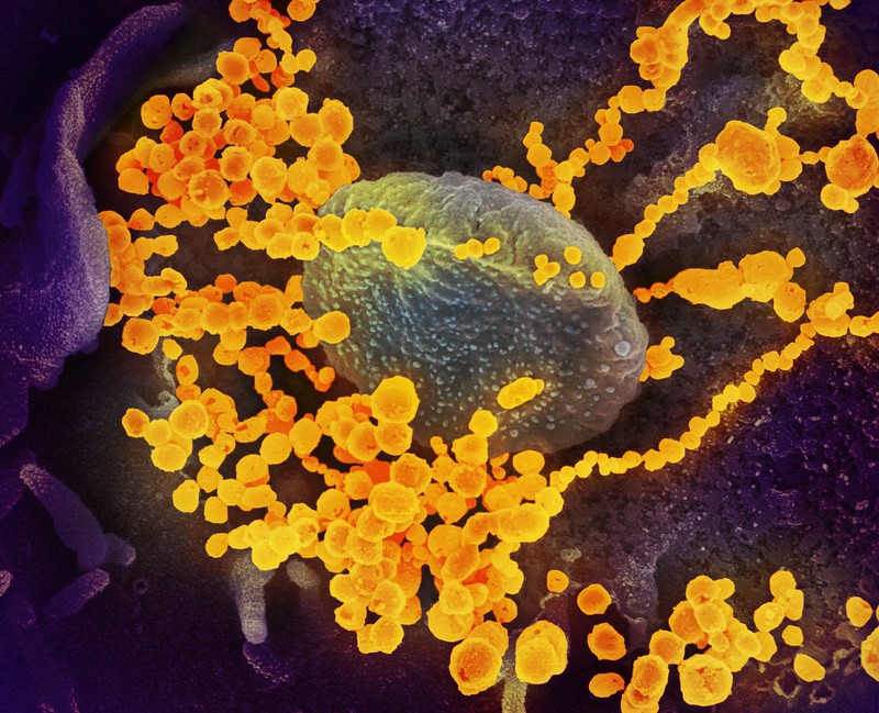 This scanning electron microscope image shows SARS-CoV-2 (round gold objects) emerging from the surface of cells cultured in the lab. SARS-CoV-2, also known as 2019-nCoV, is the virus that causes COVID-19. The virus shown was isolated from a patient in the U.S. Image captured and colorized at NIAID's Rocky Mountain Laboratories (RML) in Hamilton, Montana. Credit: NIAID